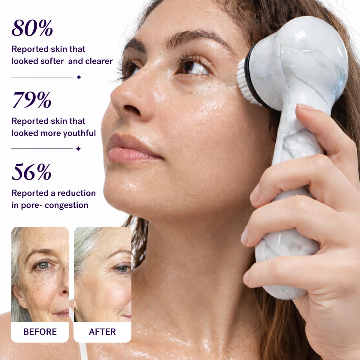 Michael Todd Beauty Soniclear Face Brush 2026 Allure Readers Choice Winner - Image 4